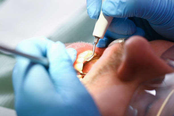 Best Emergency Treatment for Oral Infections in Sayre, PA